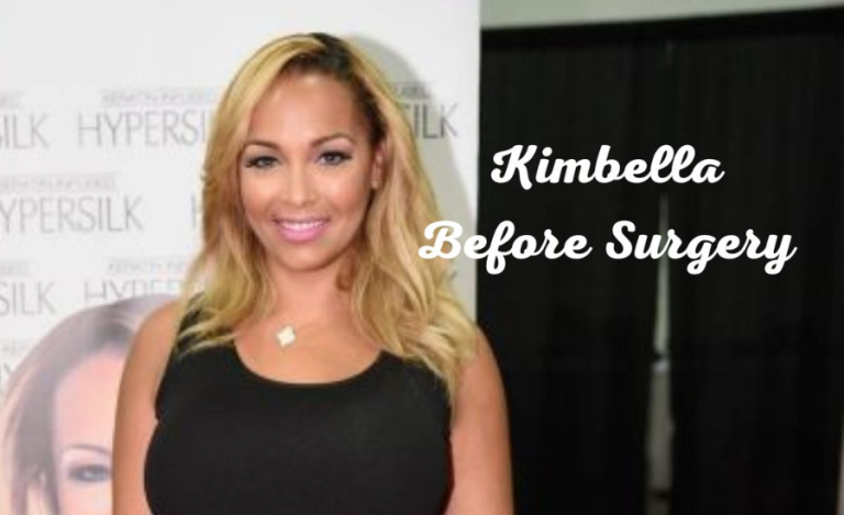 Kimbella Matos: A Look Back Before the Plastic Surgery Transformation